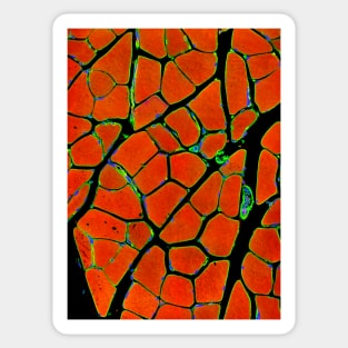 Skeletal muscle fibres, light micrograph (P154/0262) Sticker